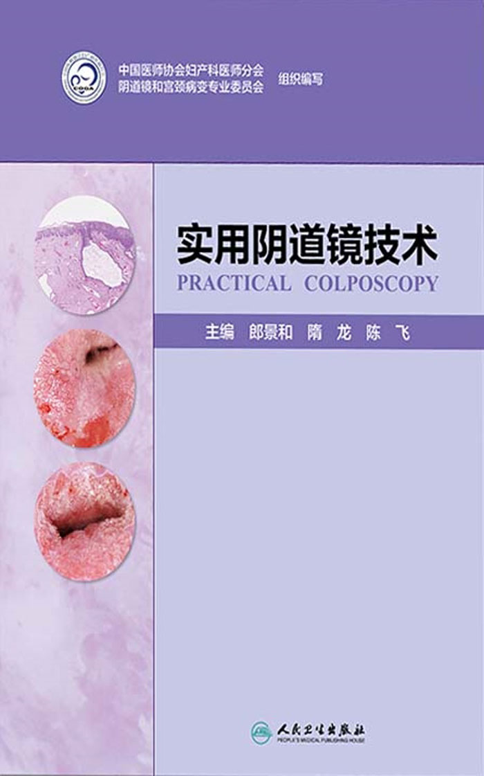 实用阴道镜技术