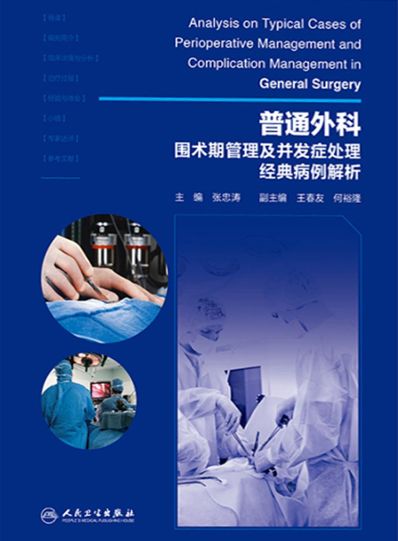 普通外科围术期管理及并发症处理经典病例解析