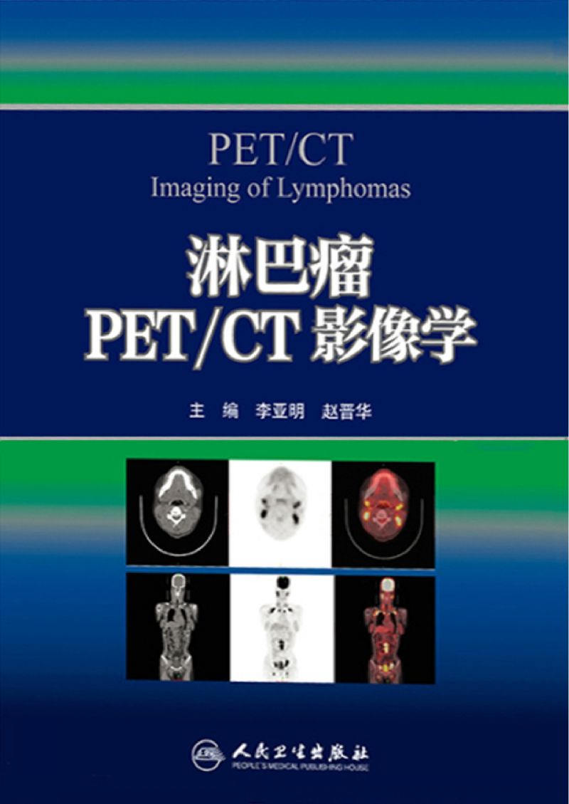 淋巴瘤PET/CT影像学