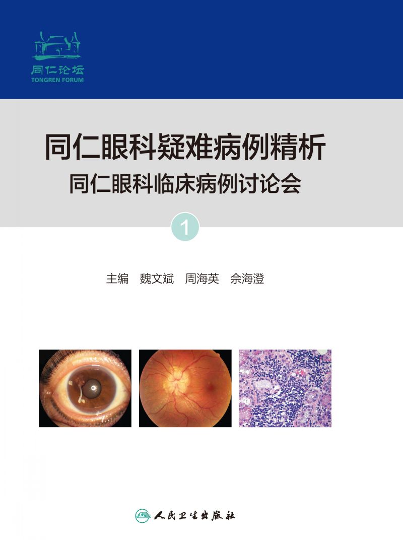 同仁眼科疑难病例精析：同仁眼科临床病例讨论会．1