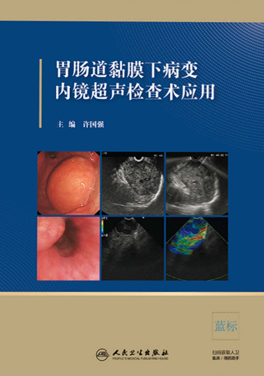 胃肠道黏膜下病变内镜超声检查术应用