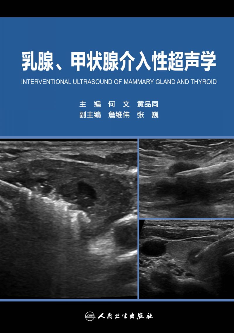 乳腺、甲状腺介入性超声学