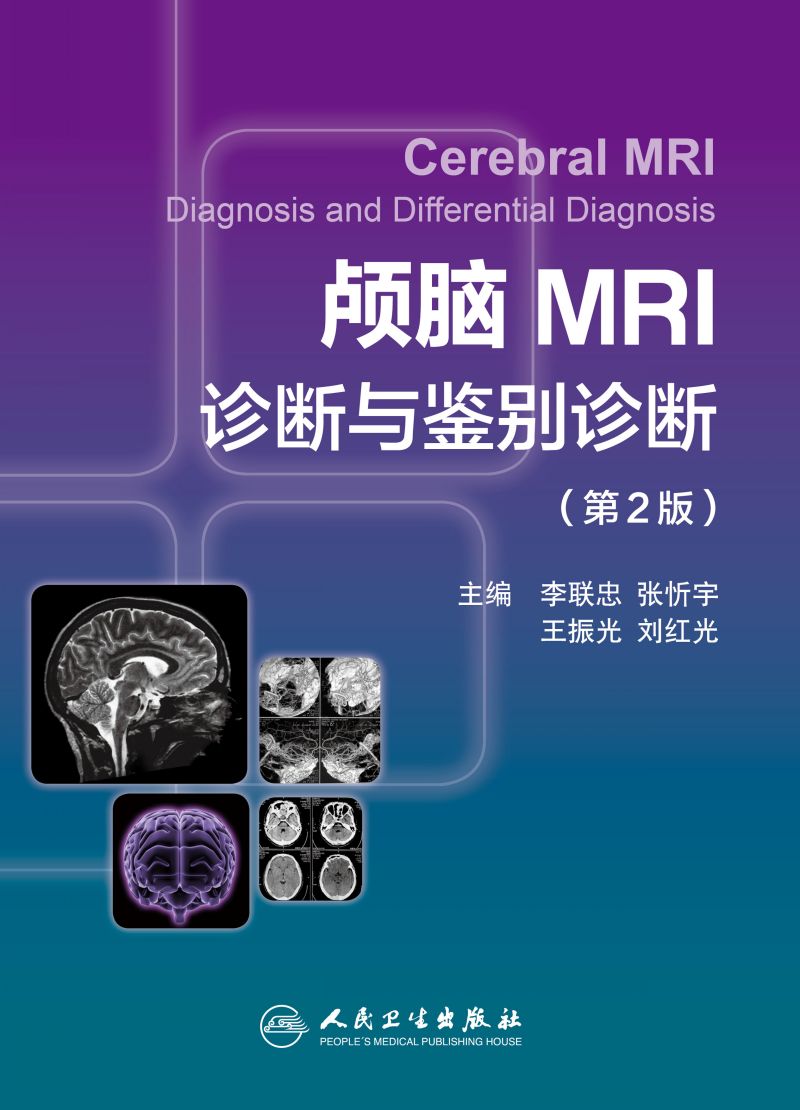颅脑MRI诊断与鉴别诊断（第2版）