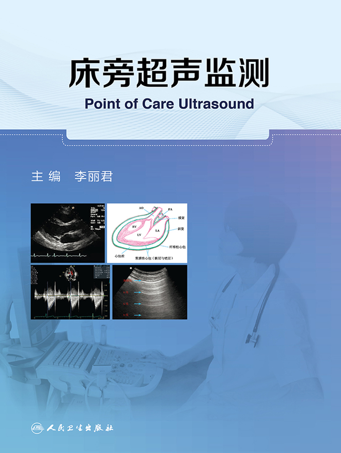 床旁超声监测