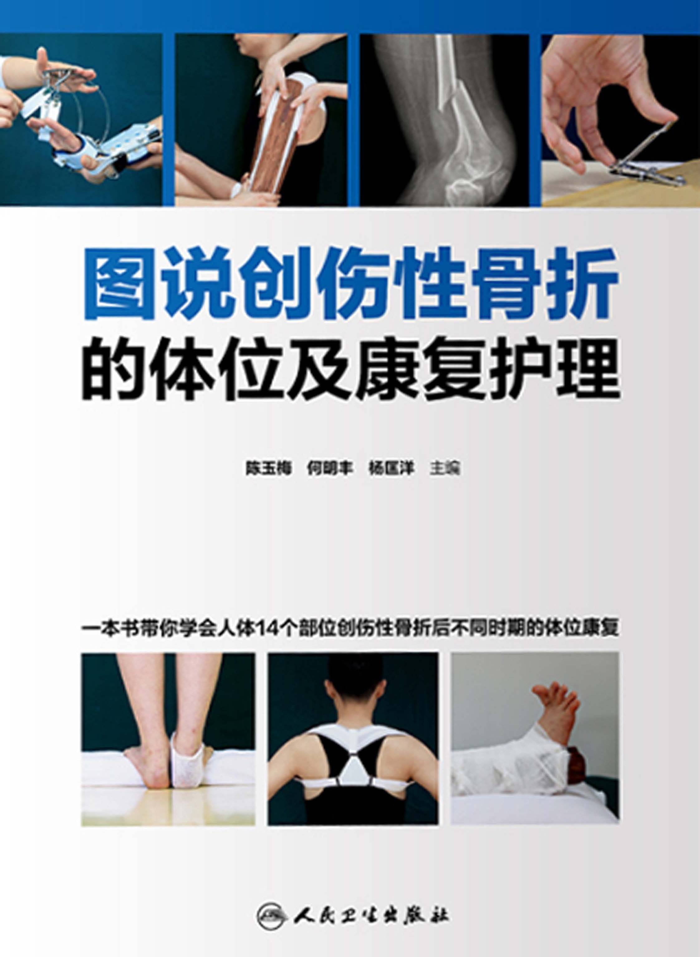 图说创伤性骨折的体位及康复护理