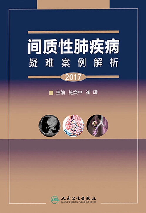间质性肺疾病疑难案例解析（2017）