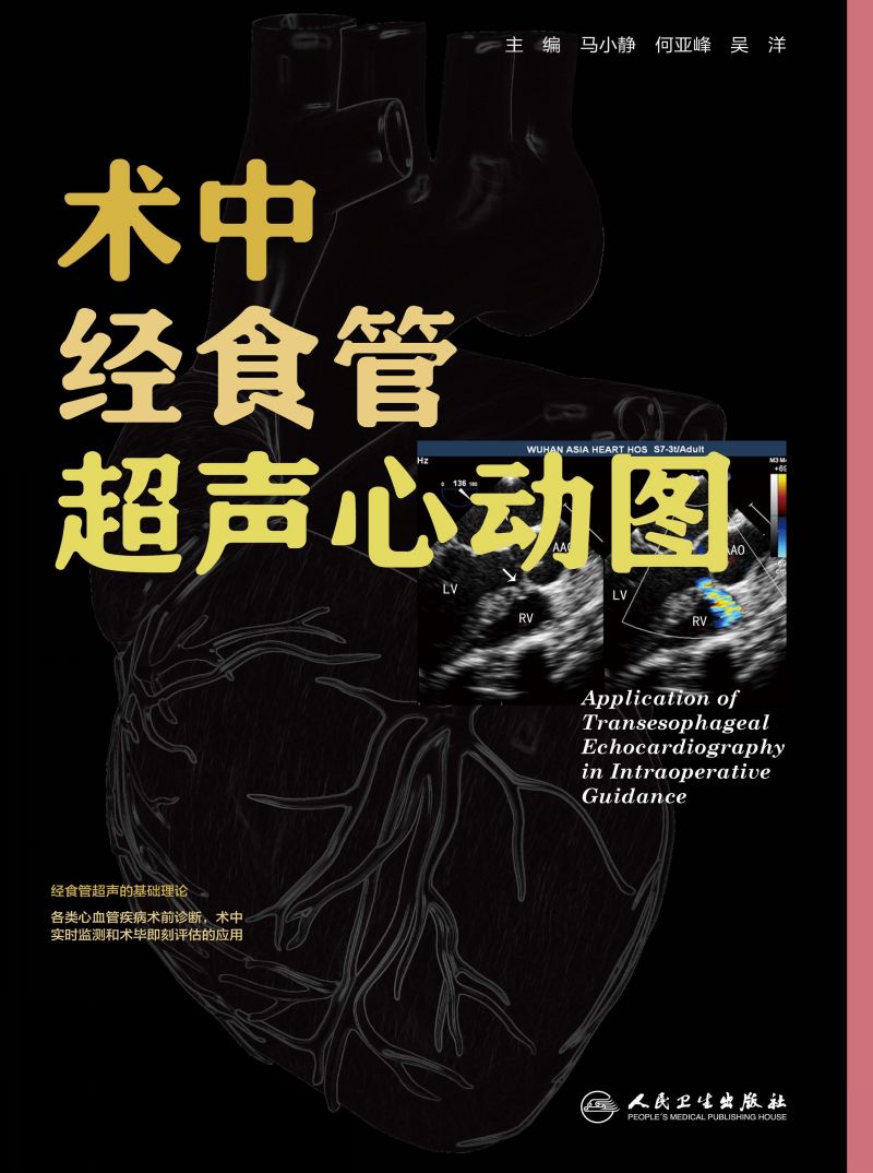 术中经食管超声心动图