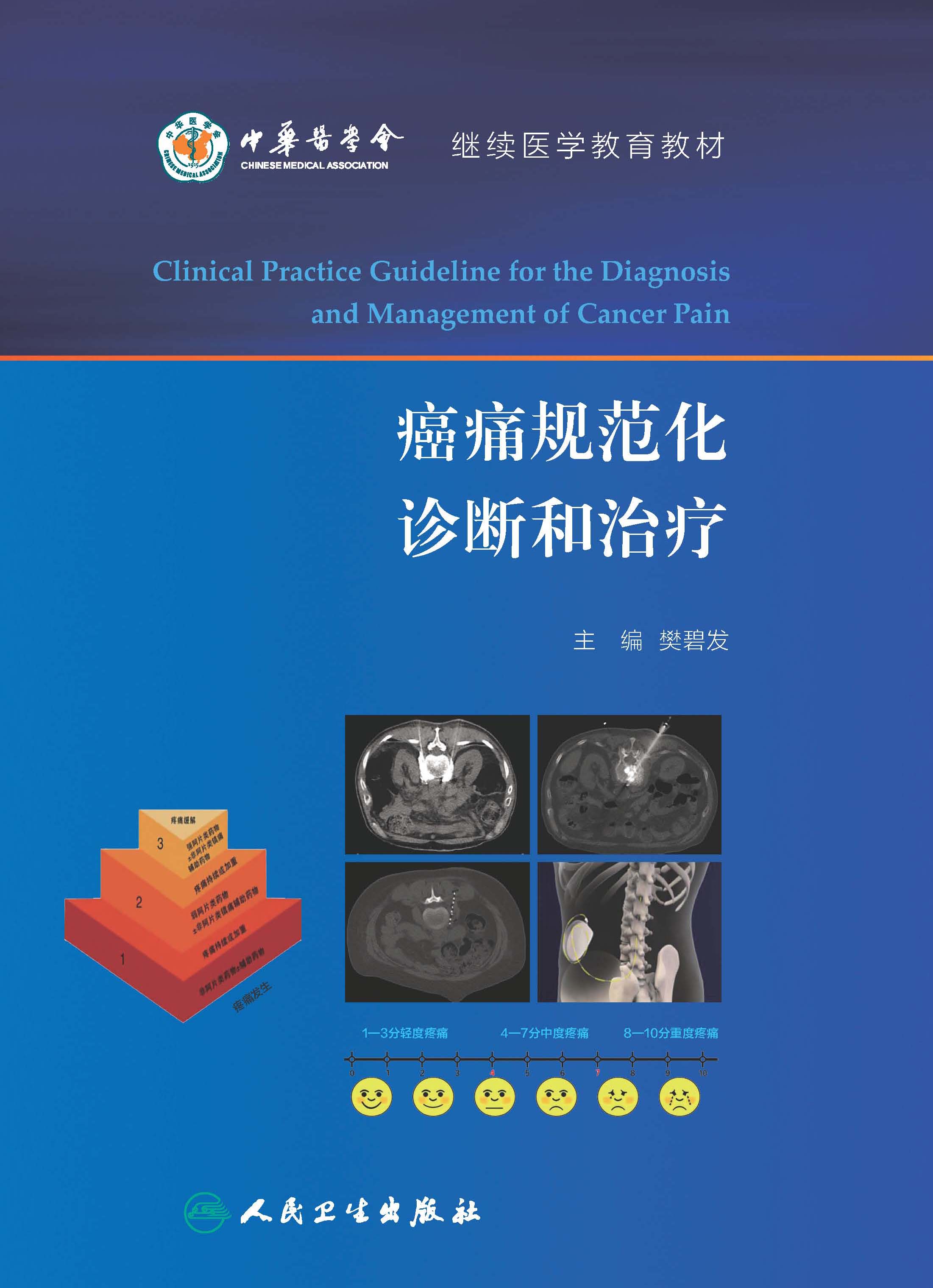 癌痛规范化诊断和治疗