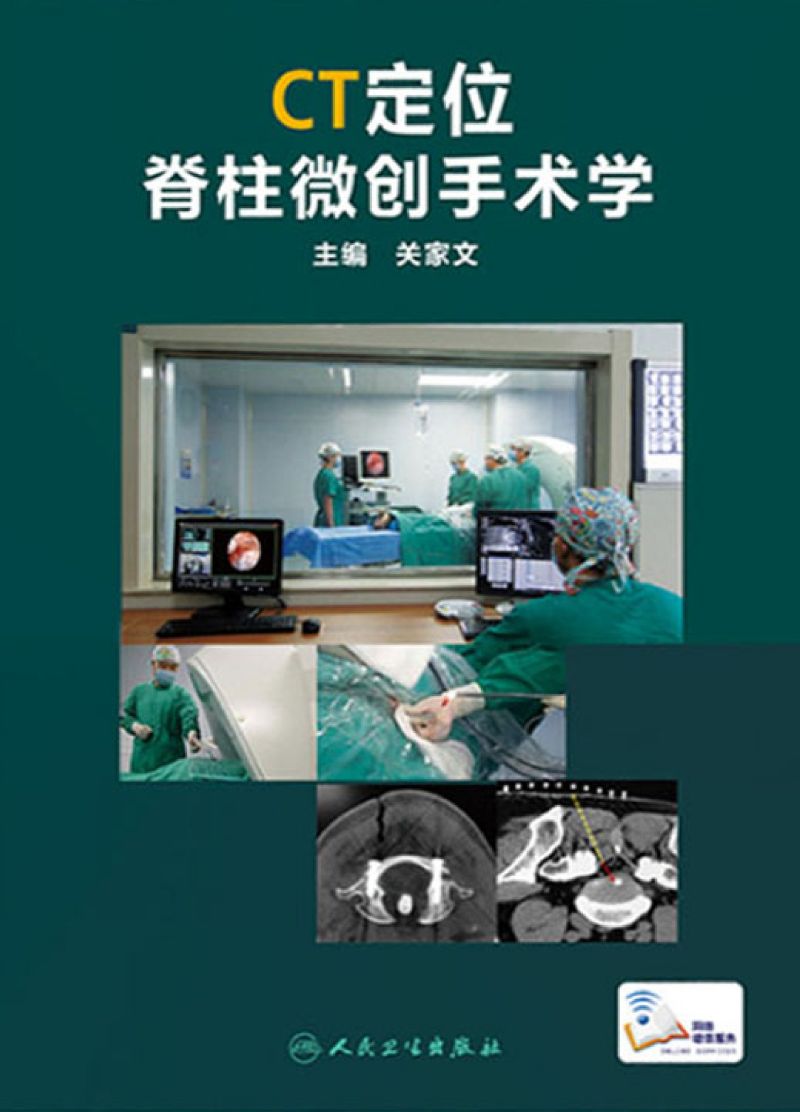 CT定位脊柱微创手术学