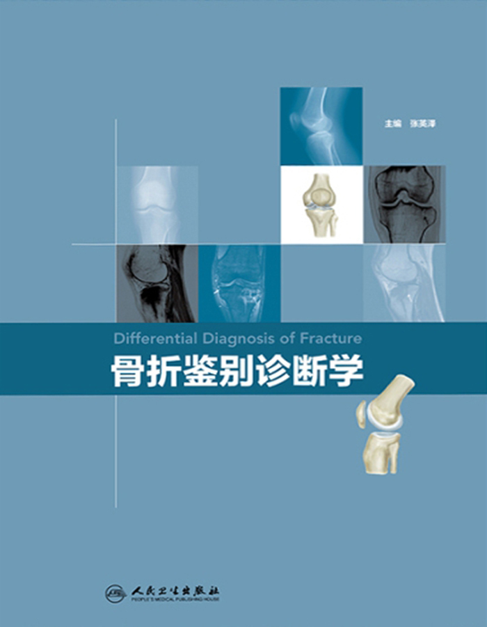 骨折鉴别诊断学
