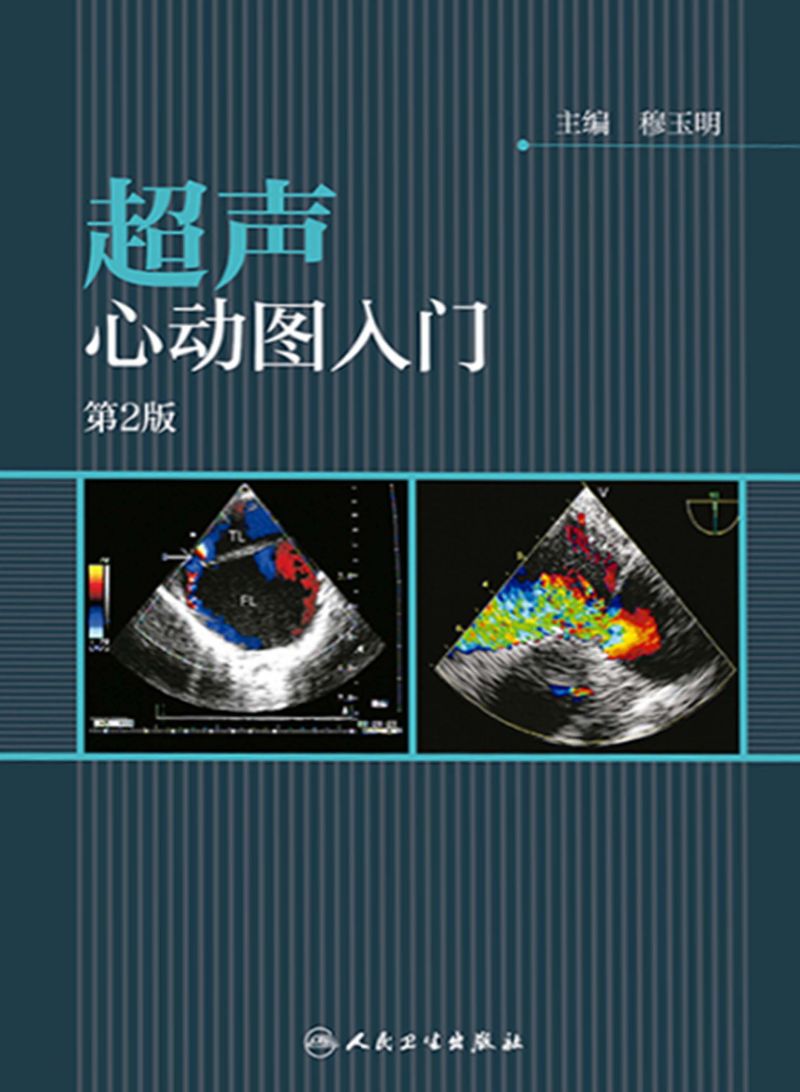 超声心动图入门（第2版）
