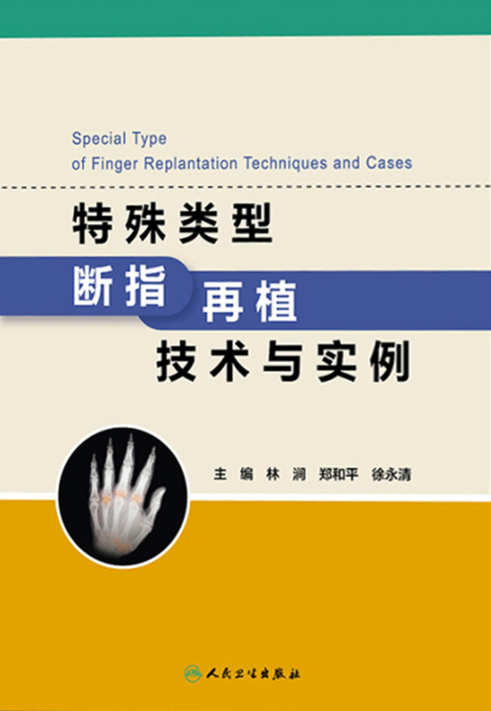 特殊类型断指再植技术与实例