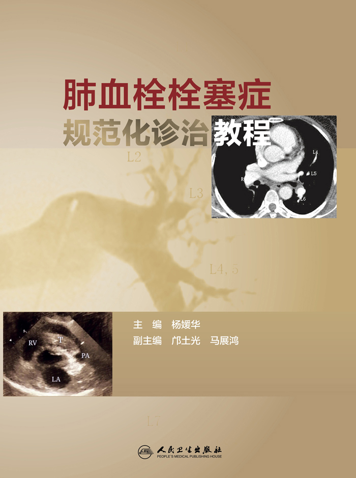 肺血栓栓塞症规范化诊治教程