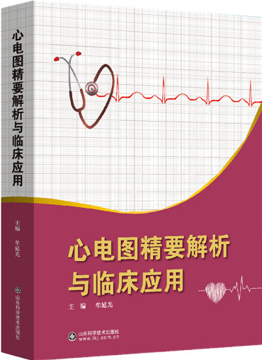 心电图精要解析与临床应用