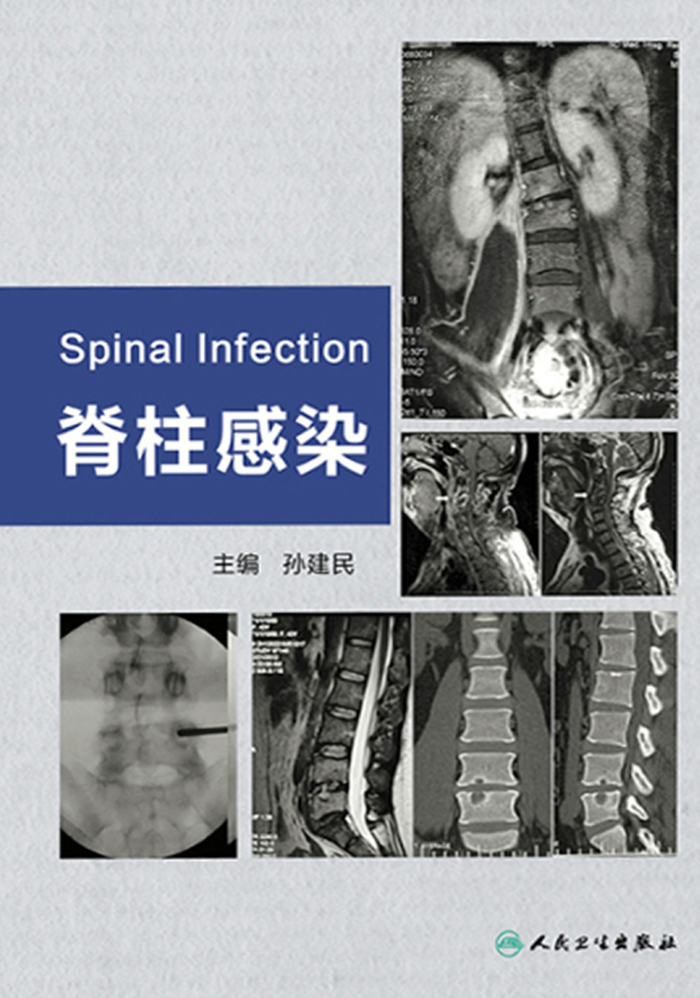 脊柱感染