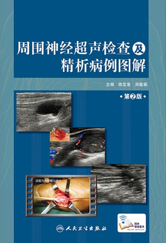 周围神经超声检查及精析病例图解（第2版）