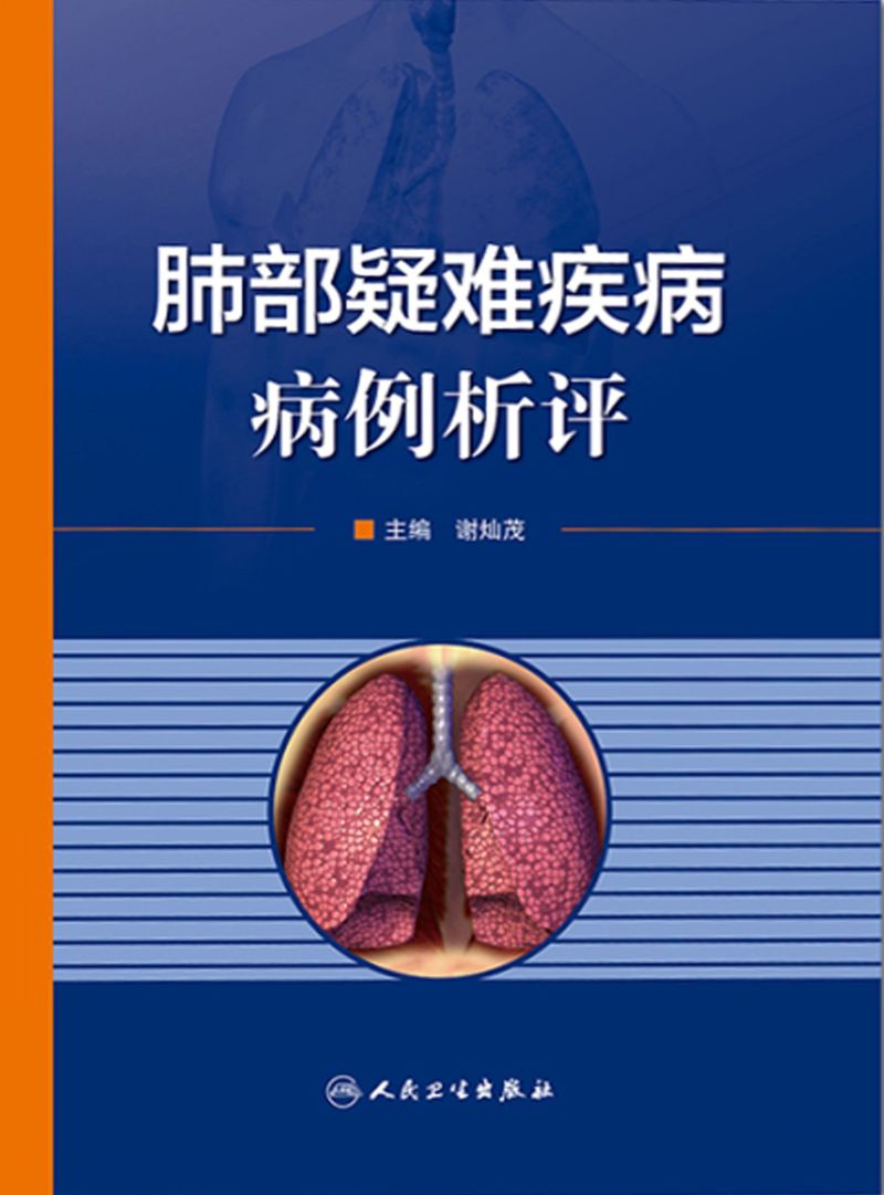 肺部疑难疾病--病例析评