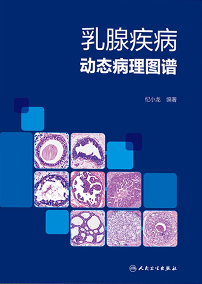 乳腺疾病动态病理图谱